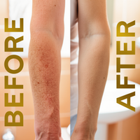 Tallow Balm | Skin Moisturizer